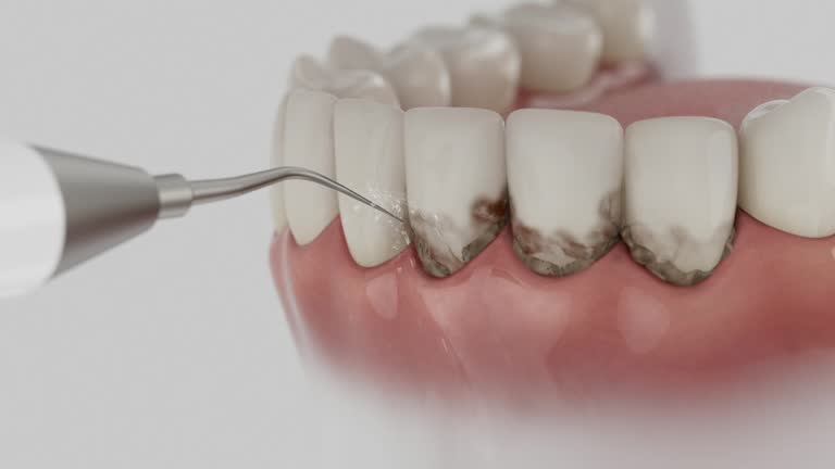 Reliable Dental Implants contractor in Vale, OR by Smile Center Dentistry